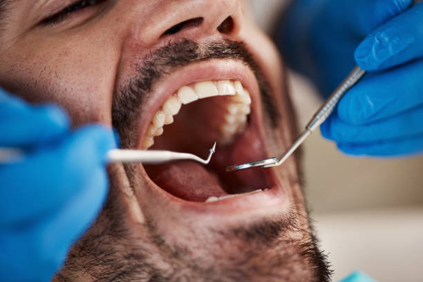 Best Urgent Dental Care for Toothaches in Humboldt Hill, CA